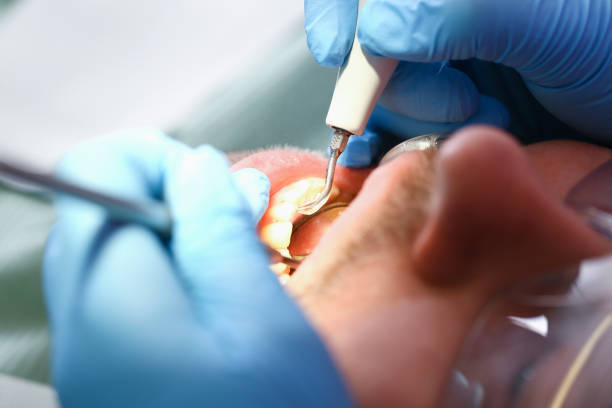 Best Emergency Cosmetic Dentistry in Spruce Pine, NC