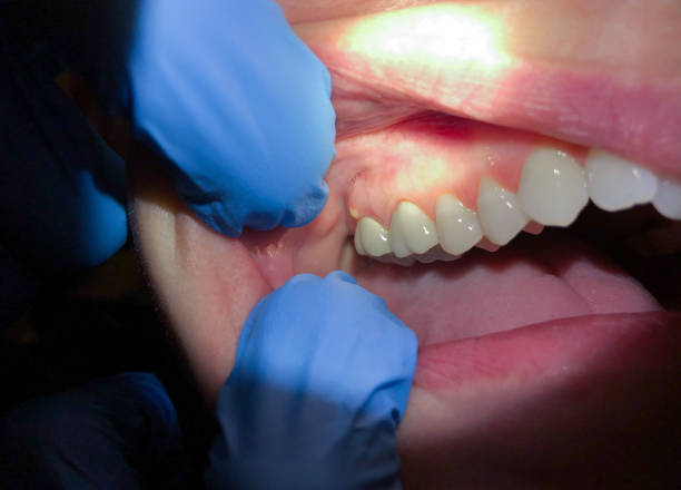 Best Emergency Cosmetic Dentistry in Spruce Pine, NC