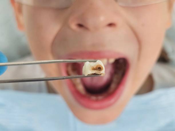 Best Weekend Emergency Dentist in Spruce Pine, NC