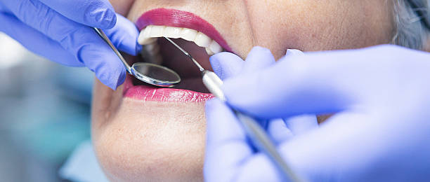 Best Emergency Dental Care for Abscessed Tooth in Spruce Pine, NC